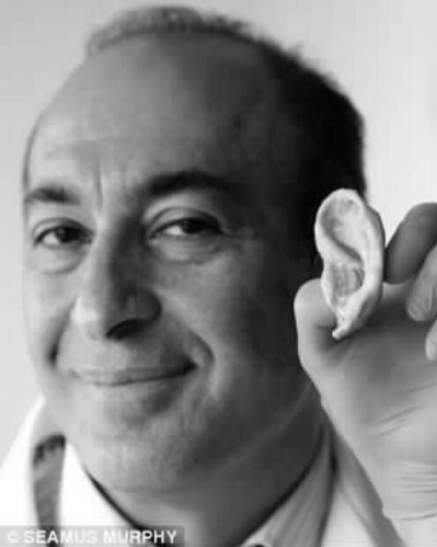 伦敦大学教授亚历山大·塞法利恩和纳米培育人造耳朵