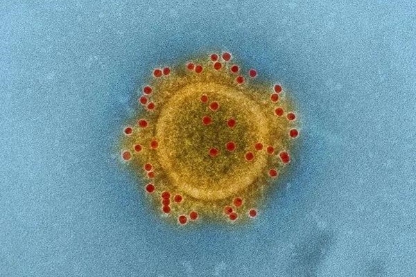 为什么那么多人反对新型冠状病毒命名为“SARS-CoV-2”，这个名字是怎么来的