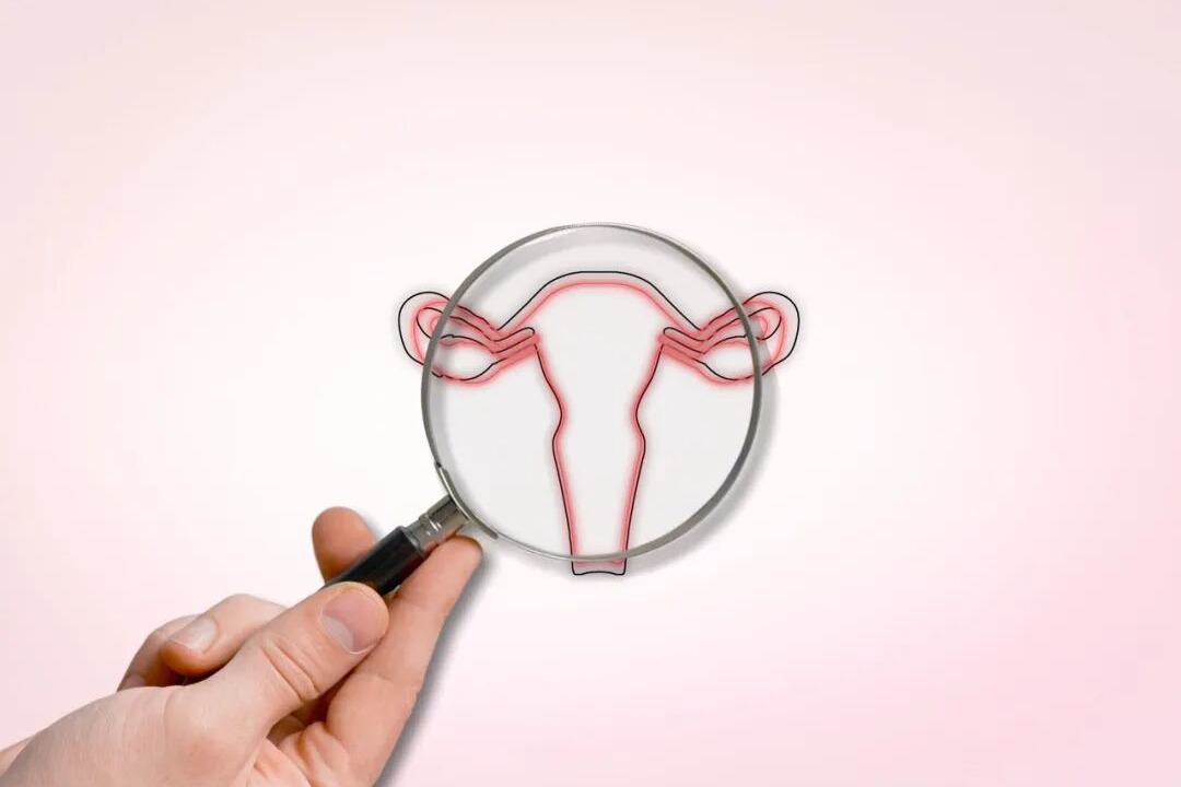 世界卵巢癌日｜它是女性的“沉默杀手”，今天一起来关注它！