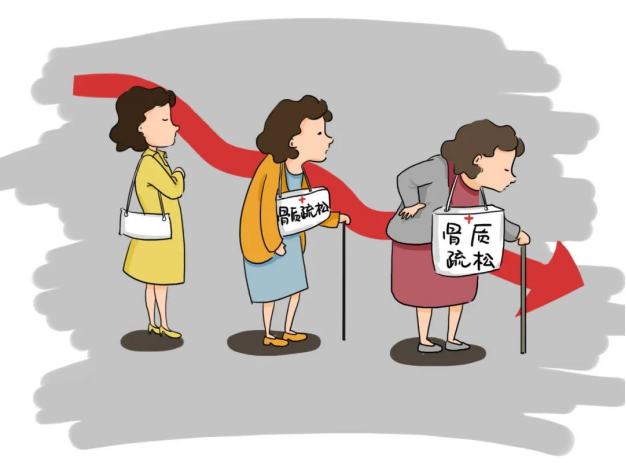 吃钙片可以预防骨质疏松吗？