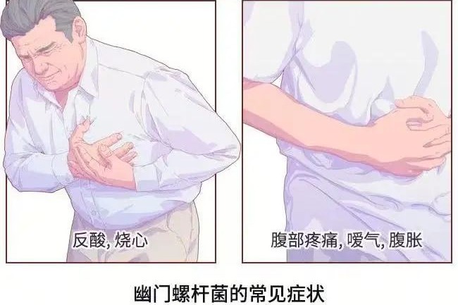想治好幽门螺杆菌感染，有一件事千万别忽略