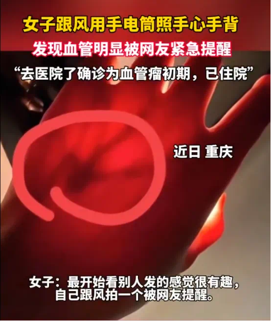 女生晒照被网友提醒有“瘤”？真的救命了！医生回应……