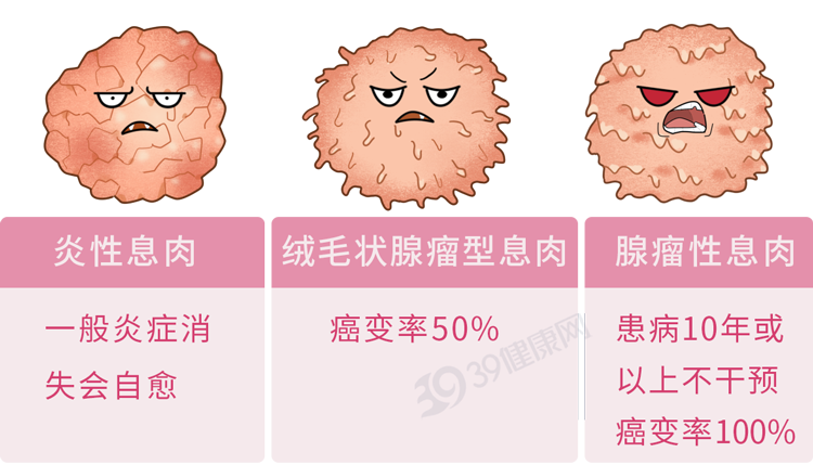 肠息肉不能切，会越切越多？