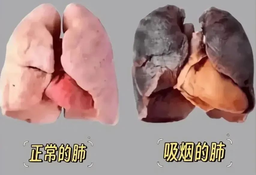 世界上受辐射最多的人，可能就在你身边……