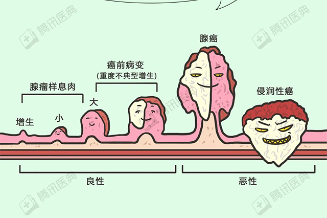 息肉，到底是个什么东西？