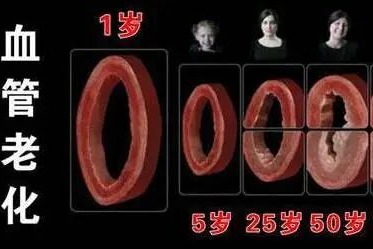 血管堵没堵，弯腰摸这里就知道！一个小动作帮你远离血栓