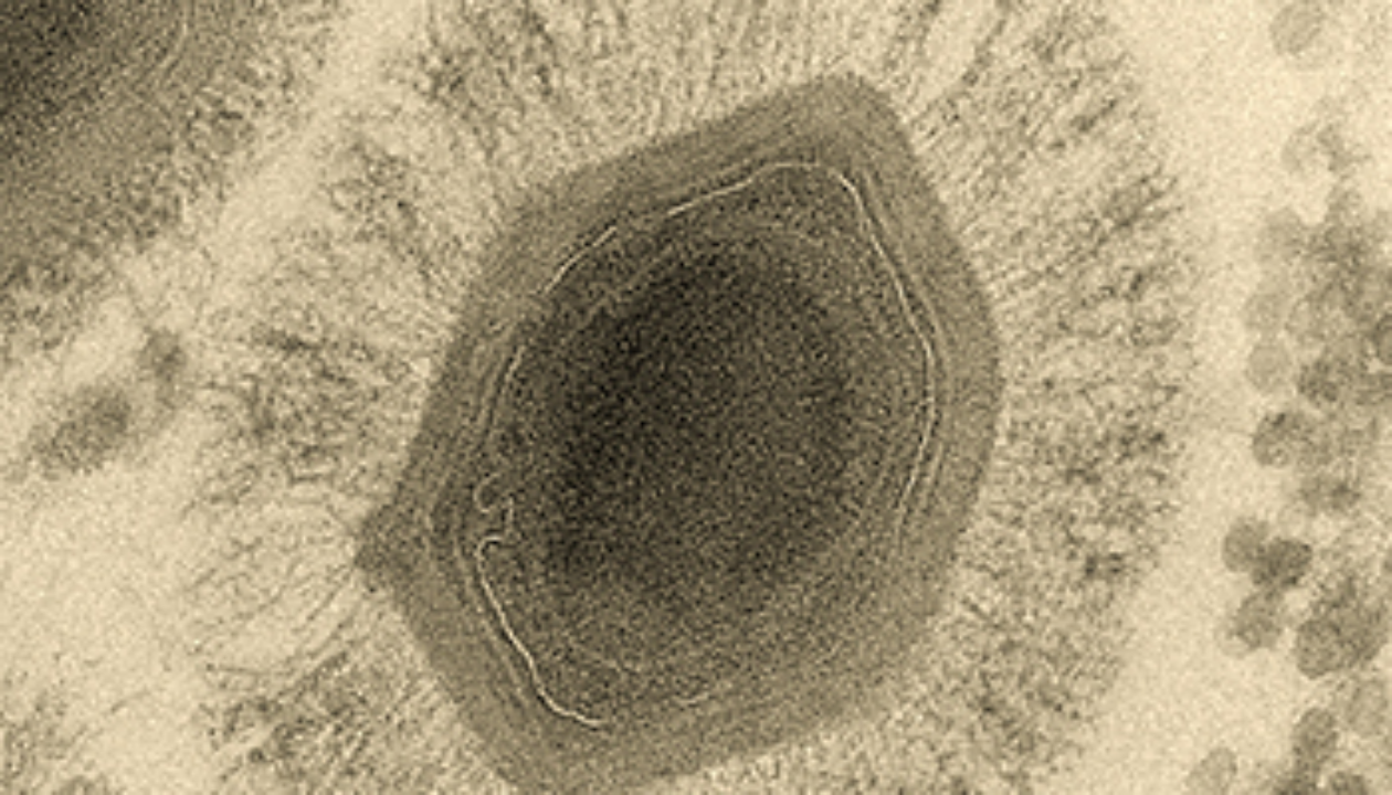 image.gif