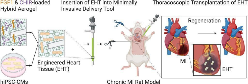 告别开胸手术？干细胞贴片为心衰患者带来新希望