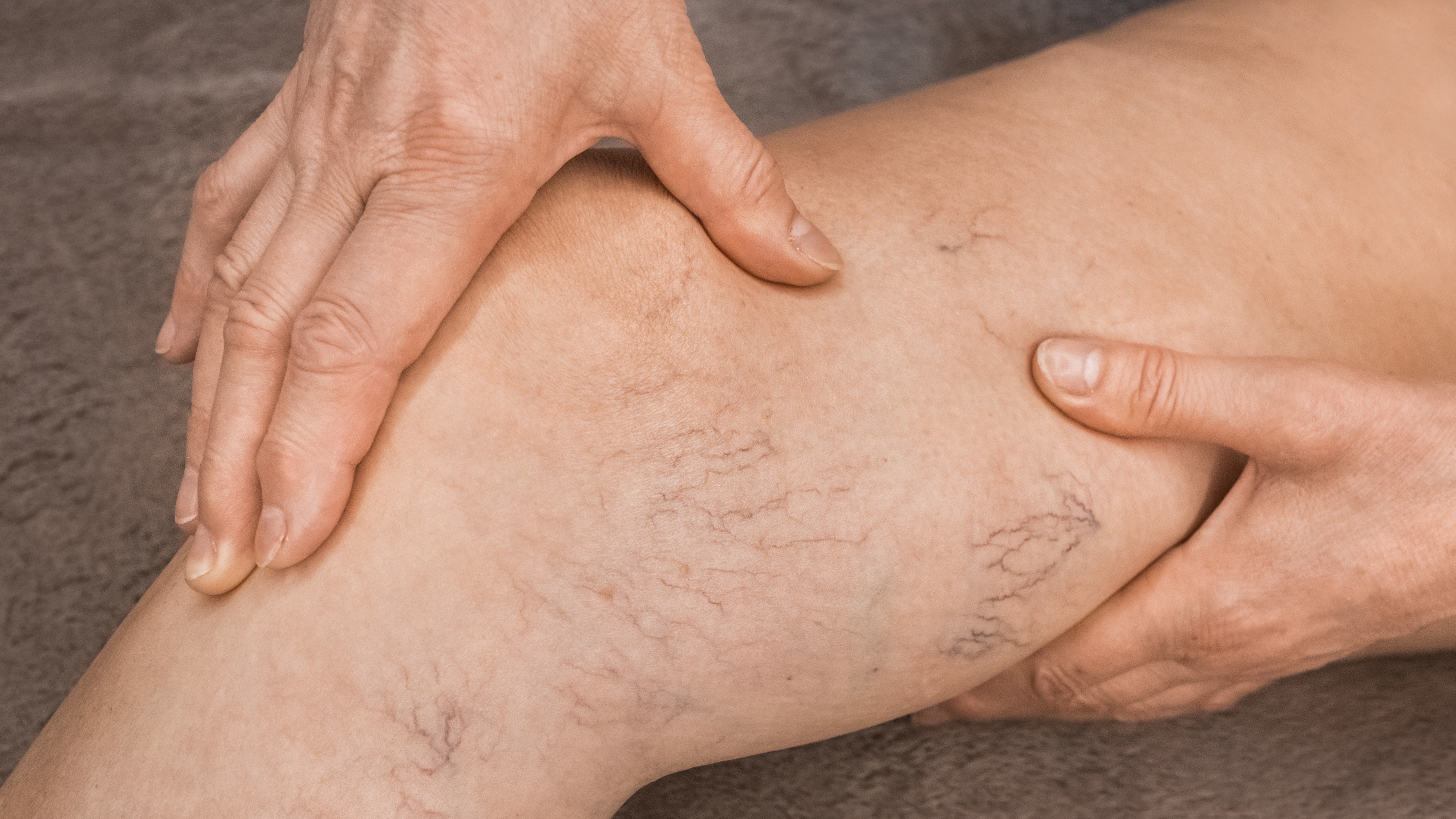 久坐久卧藏隐患，警惕静脉血栓栓塞症