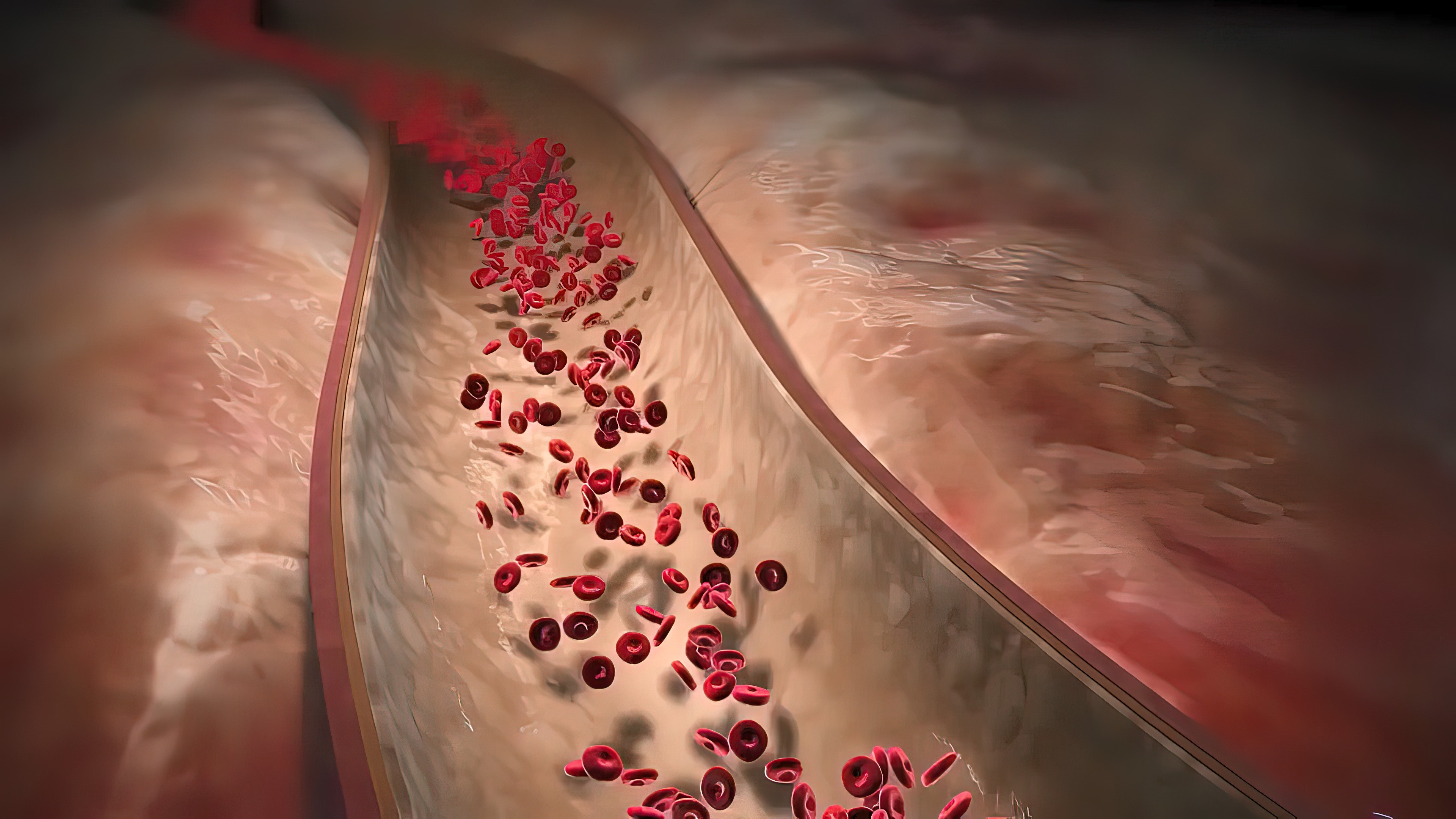 血管长斑块别慌,做好 6 件事给血管 “大扫除”