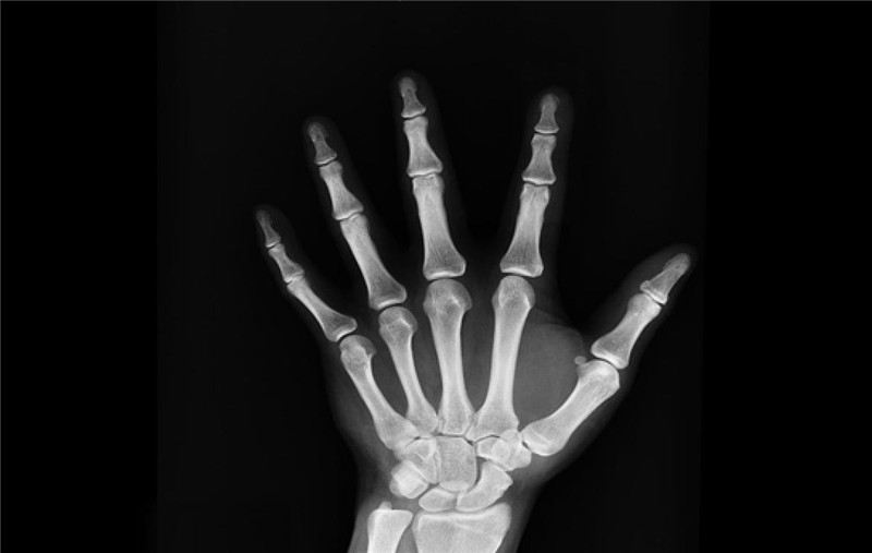 photo%2F0009%2F2018-03-26%2FDDQQ7VP30AI20009NOS