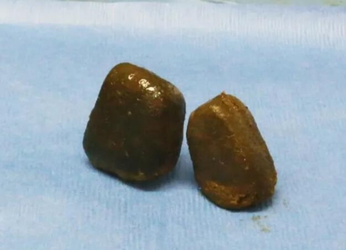 Poo