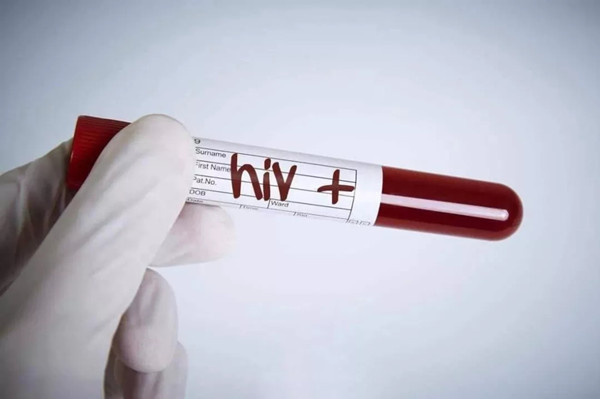 面对艾滋病依然束手无策，HIV疫苗研制为何这么难？