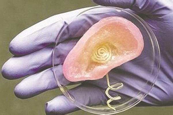 3D printing injects future into medical industry
