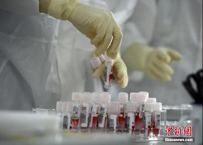 实验室工作人员整理刚刚送来的经预处理后的新冠病毒核酸检测的样本。中新社记者 侯宇 摄