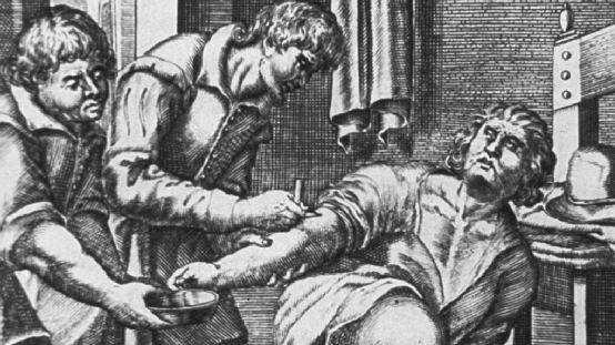 医生给病人放血，图片来源 National Library of Medicine