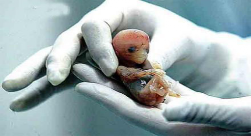 人类胚胎研究“14天准则”，为什么会被打破？