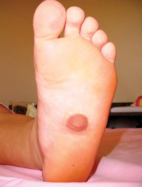 为什么人只有两个乳房可不少动物却能长一排