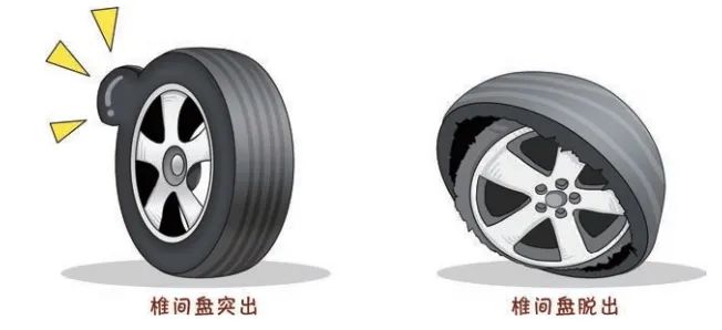 椎间盘膨出、突出、脱出，有什么不一样？