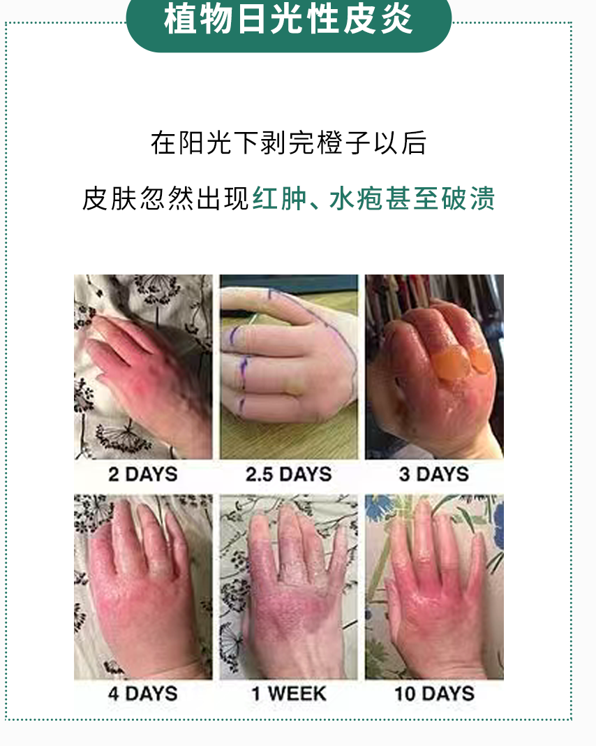 在夏天的阳光下剥橙子，为什么是“作死”？