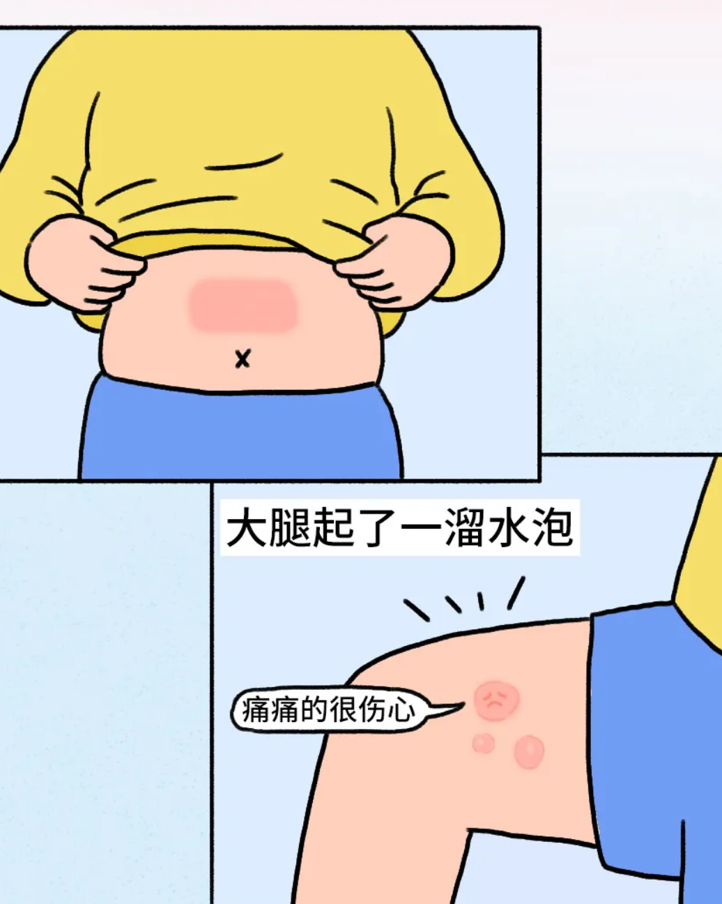 “我也没感觉烫，咋就烫伤了？”