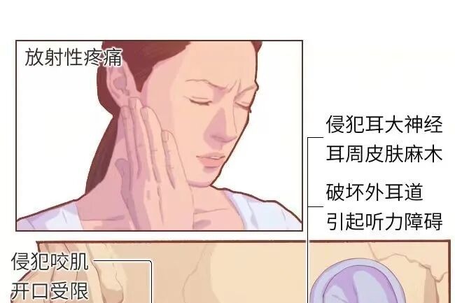 脸上有这个特征，警惕1个肿瘤信号