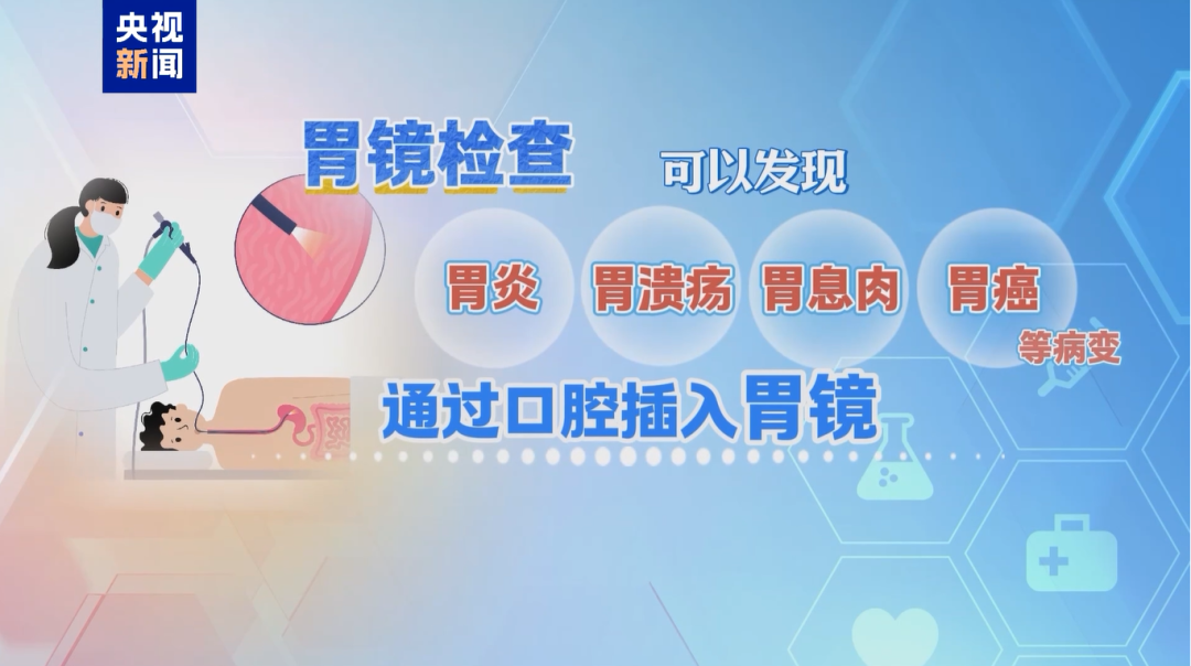 位列癌症发病率前五，七成患者确诊时已为中晚期，这个检查很有必要
