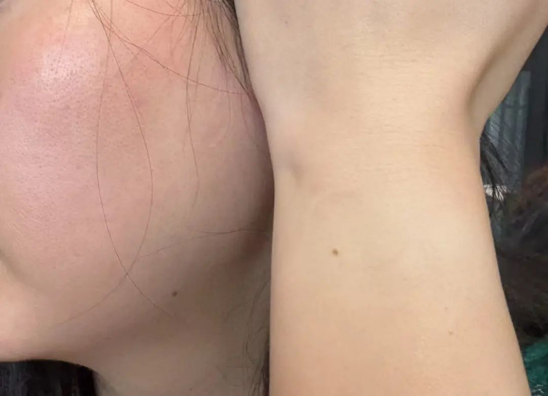 “防晒面罩越戴越黑”！是热黑的还是捂黑的？