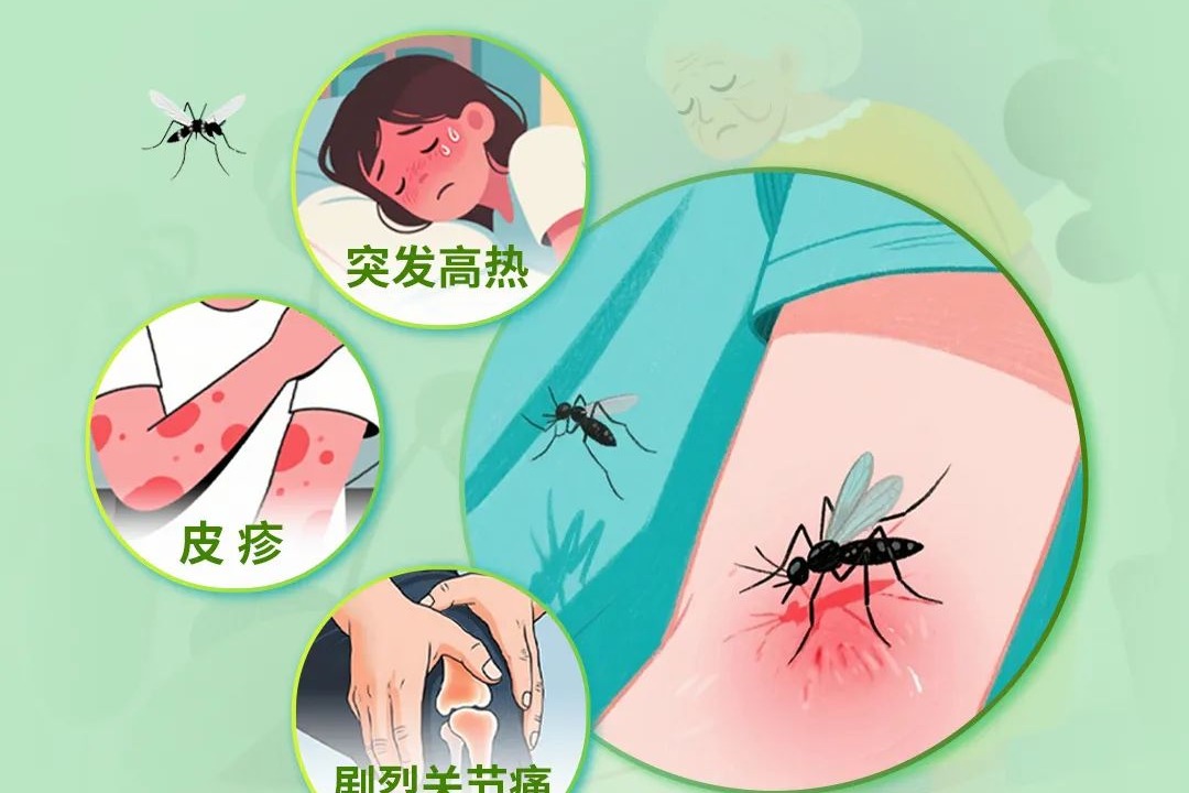 基孔肯雅热为何在今年夏天病例数上升？与这些因素相关