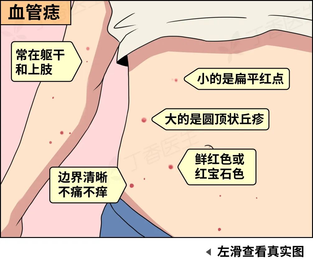 身上突然冒出来的小红点，到底是啥啊？