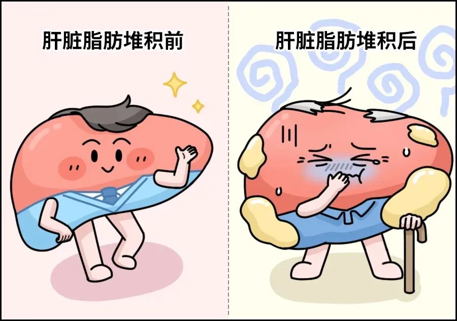 喝下去的糖 vs 吃下去的糖，哪个对身体危害更大？