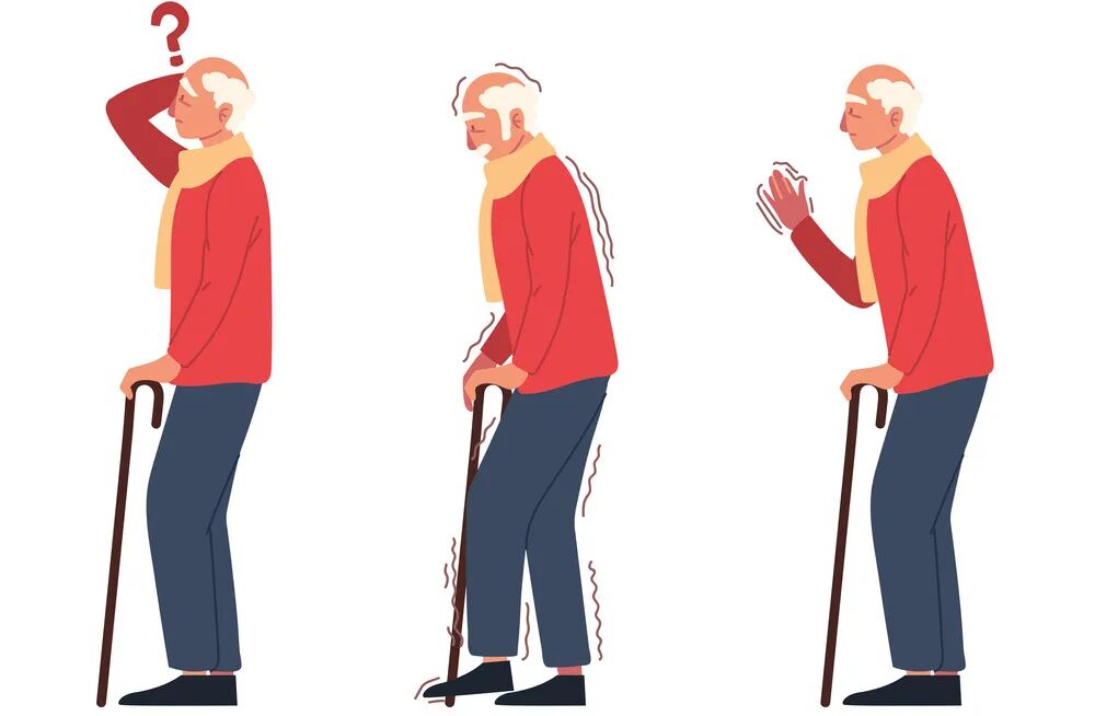 帕金森病的5个常见谣言