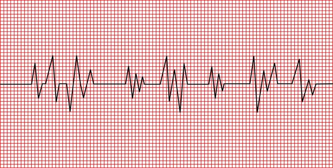 单凭心电图“ST-T段改变”诊断心肌缺血？你又错了……