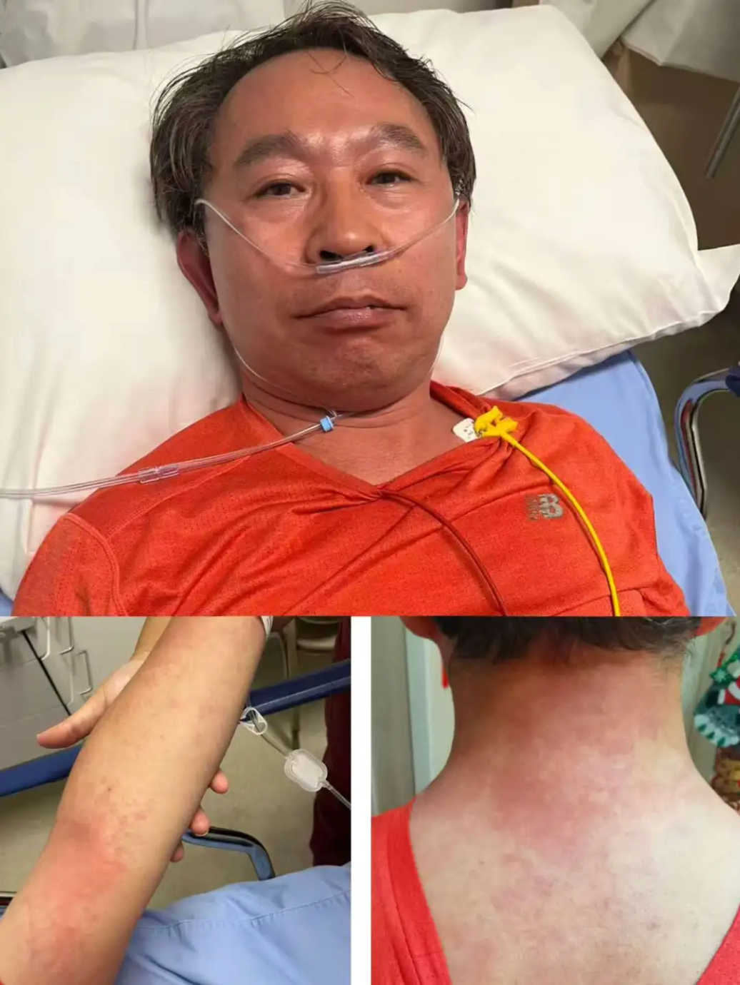 协和医生自述头孢过敏惊险经历，提醒大家：吃药一定注意这些事