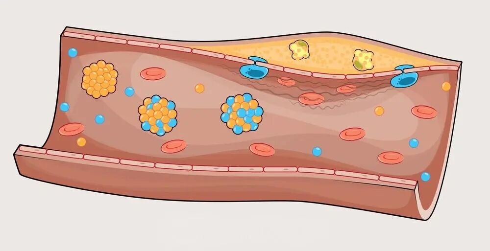 带你认识化验单上的常客——不同名字的脂蛋白